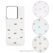 گارد شاین شفاف شیائومی NOTE 14 4G